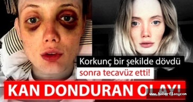 Kan donduran olay! Sevgilisi Rus mankeni önce dövdü sonra tecavüz etti!